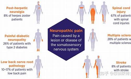疼痛神经发达代表什么生肖_疼痛神经在哪